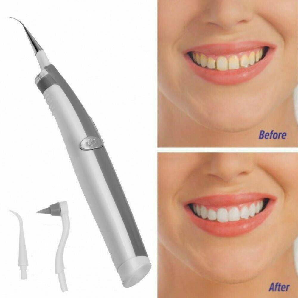 PULIZIA DENTI AD ULTRASUONI CON LED RIMOZIONE TARTARO PLACCA MACCHIE